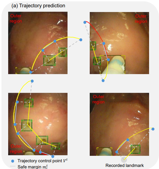 Trajectory prediction examples for ESD circumferential incision