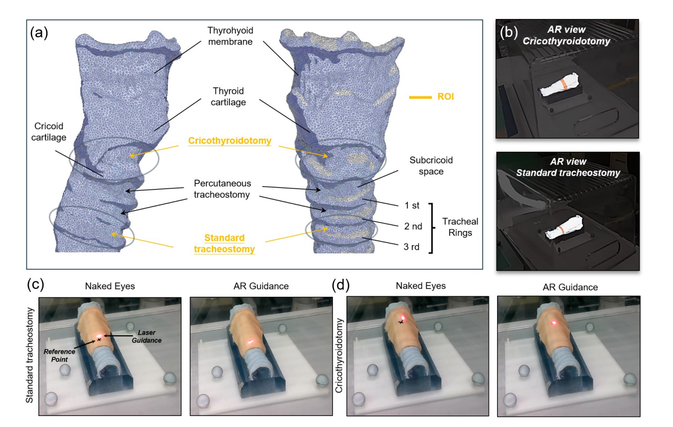 AR-assisted incision guidance for tracheostomy planning